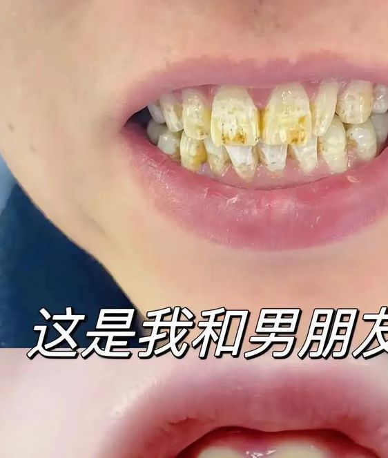 两个人黄牙视频APP