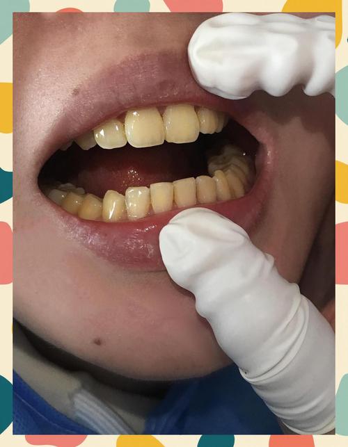 两个人黄牙视频APP