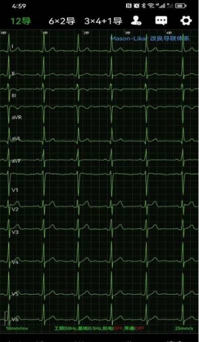 心电一张网最新版